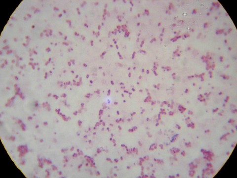 炭疽杆菌油镜图片; 巨大芽孢杆菌