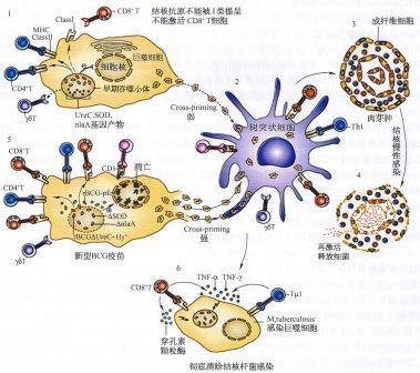 得了肺结核还能上五险 有肺结核能办社保吗
